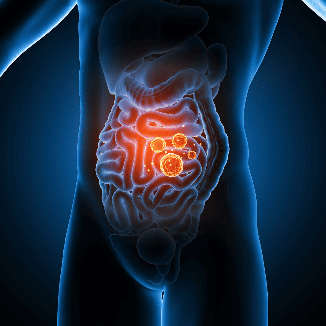 inflammed intestines, leaky gut