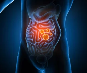 Understanding Intestinal Permeability or “Leaky Gut”